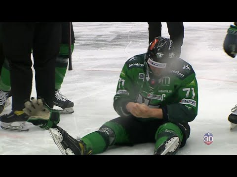 Juraj Mikúš prišiel po neúmyselnom zákroku hokejkou od Juraja Šišku o niekoľko zubov
