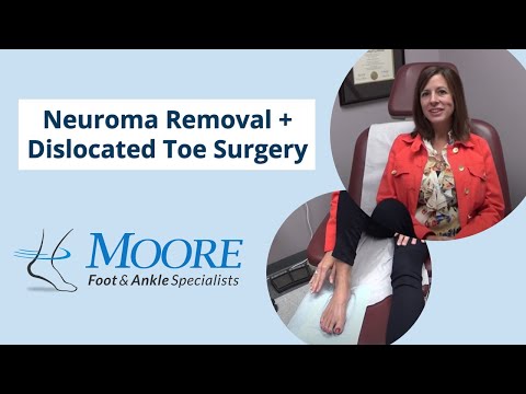 Ask Dr Moore Foot and Ankle FAQ Frequently Asked Questions Video Offering