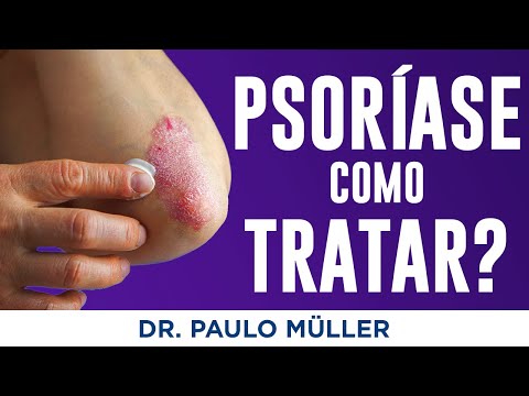 Psoríase: Causas e Tratamentos - Dr. Paulo Müller Dermatologista