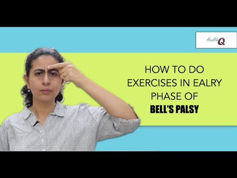 image-What is the fastest way to cure Bell's palsy?