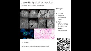 Case 55: Typical or Atypical Fat