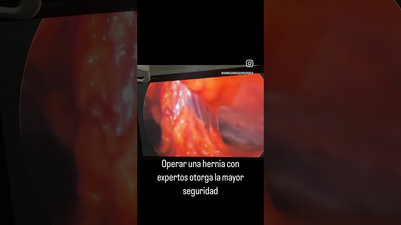 Luis Angel Medina Andrade-43