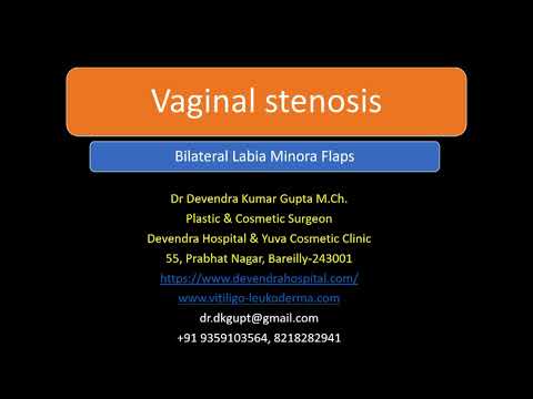 download lagu mp3 mp4 Labia Minora, download lagu Labia Minora gratis, unduh video klip Labia Minora