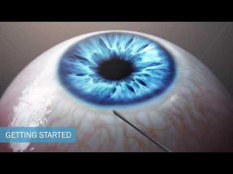 iTrack Canaloplasty