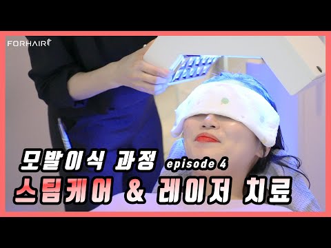헤어라인 이식 후 스팀+레이저 치료, 풍성한 케어서비스 반할수밖에! ep.4 | 비절개 모발이식 | 포헤어 서울
