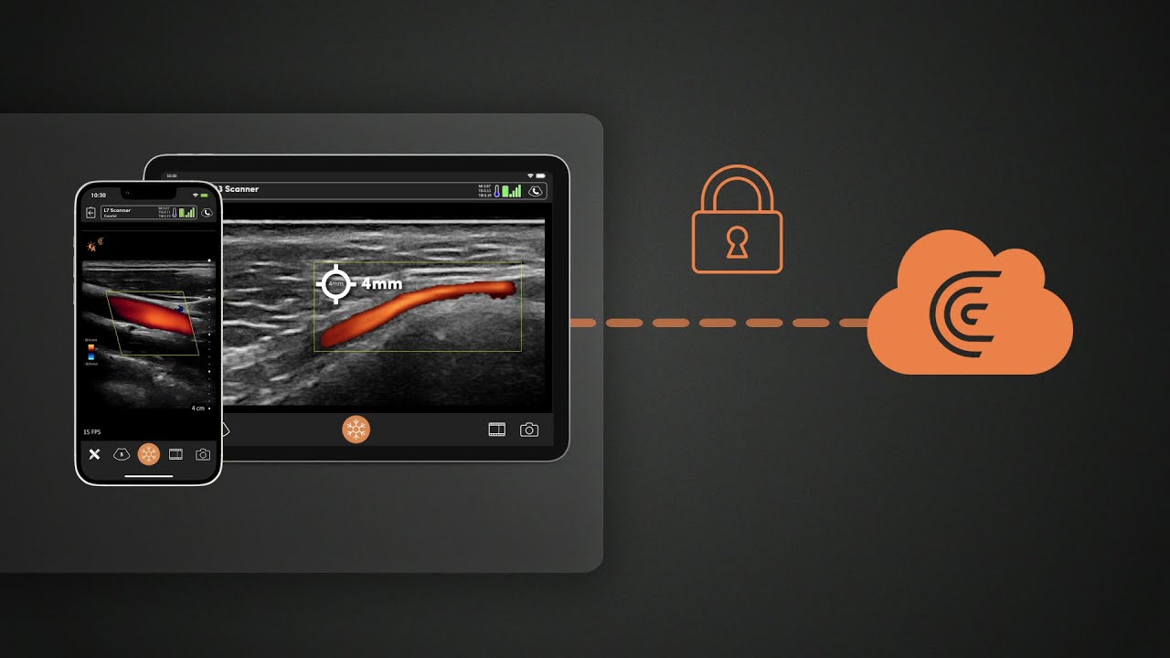 How to Use Clarius Cloud