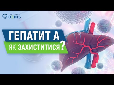 Гепатит А: как защититься? - TOP Clinic DENIS