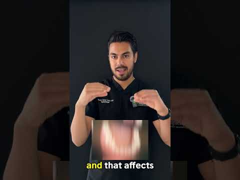 Full Mouth Restoration by Dr. Alonso Yañez