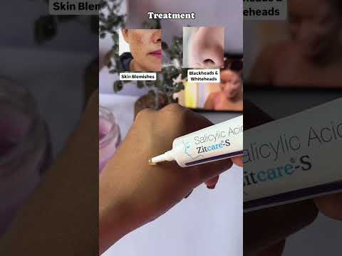 salicylic acid gel 💗