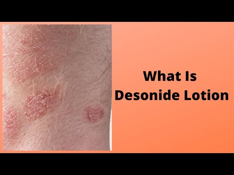 Desowen desonide cream, as suggested by physician, packaging...