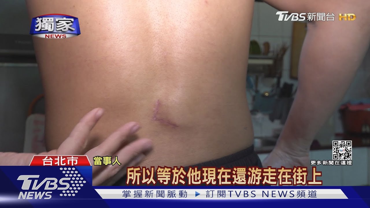 生活全變調!街頭無辜遭砍 「復健」倒水都難