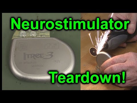 EEVblog #1027 -  Implantable NeuroStimulator Teardown