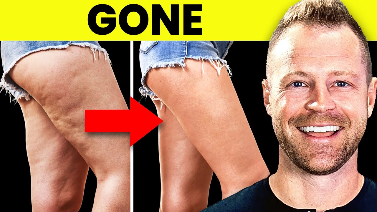 Get Rid Of CELLULITE Following This Simple Routine [Naturally]