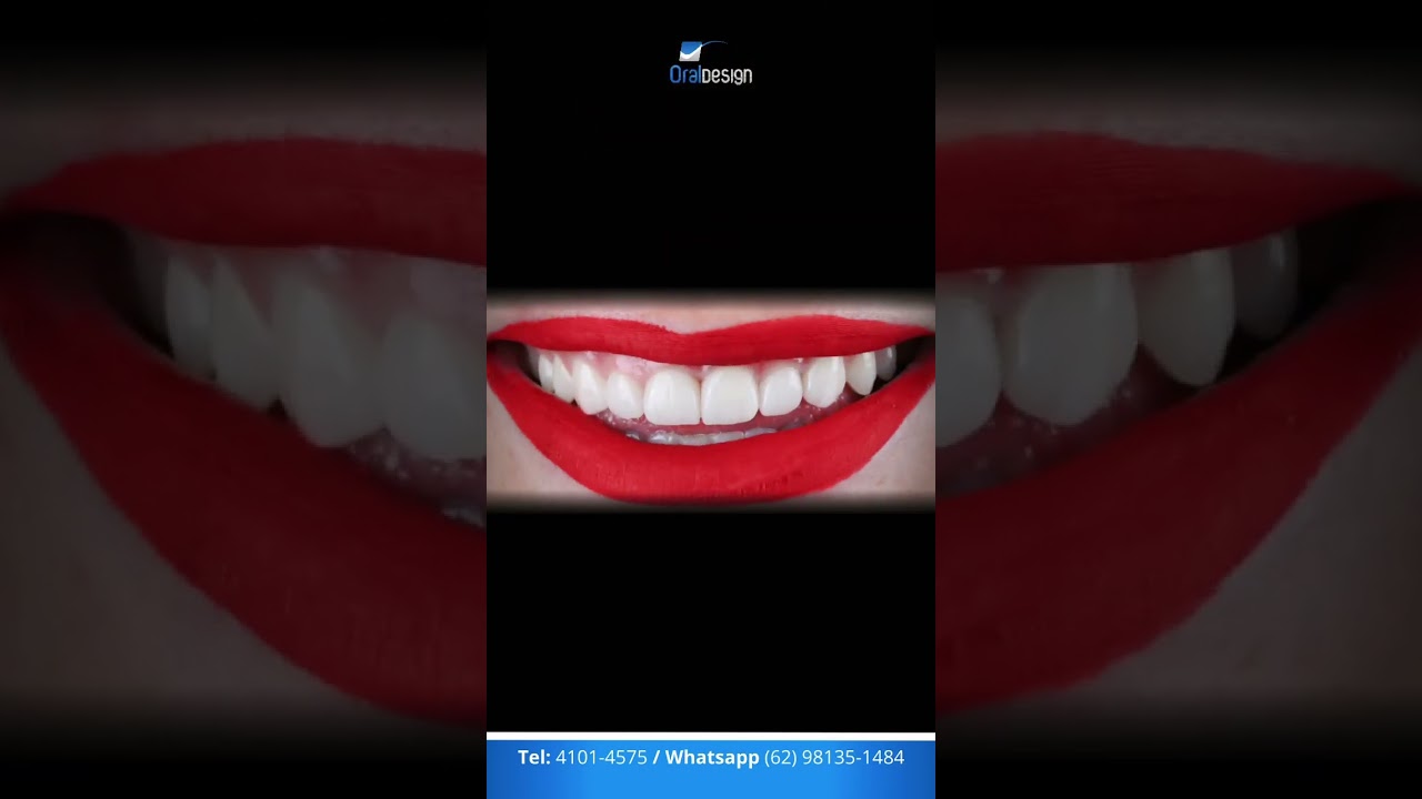 Danilo Monteiro Rezende Pereira-53