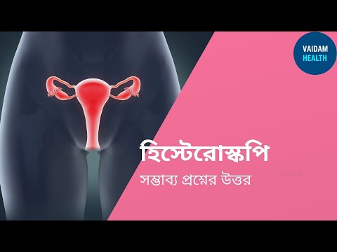 হিস্টেরোস্কোপি- প্রায়শই জিজ্ঞাসিত প্রশ্ন