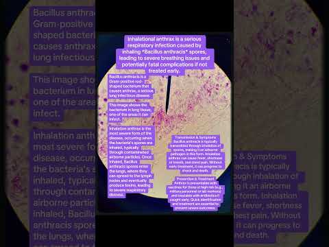 Inhalational anthrax is Bacillus anthracis spores, leading to severe breathing issues #microbiology