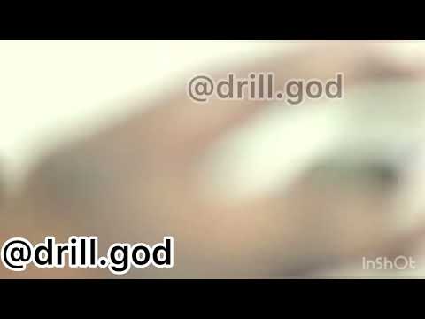 Tanna (#031 Bloods) Talking about the Time he Allegedly got Stabbed/Bottled by #PYG/#Peckham in 2010