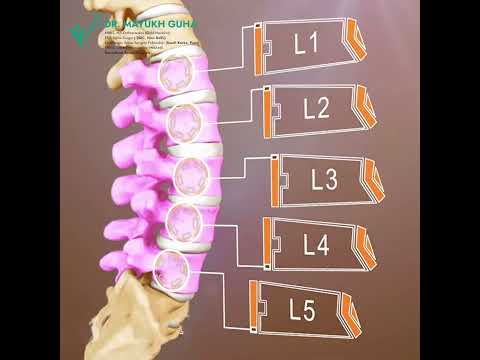 Surgery didn’t help in long term? Understand the reasons with Dr. Mayukh Guha