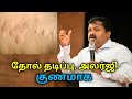 தோல் அலர்ஜி தடிப்பு குணமாக இயற்கை மர�