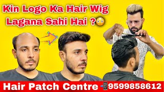 Hair Patch For Men | Hair Patch Work | Hair Transformation With Natural Hair Look | 9599858612
