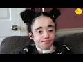 The Only Known Case Of Her Genetic Disorder And The Mom Who Saved Her Life