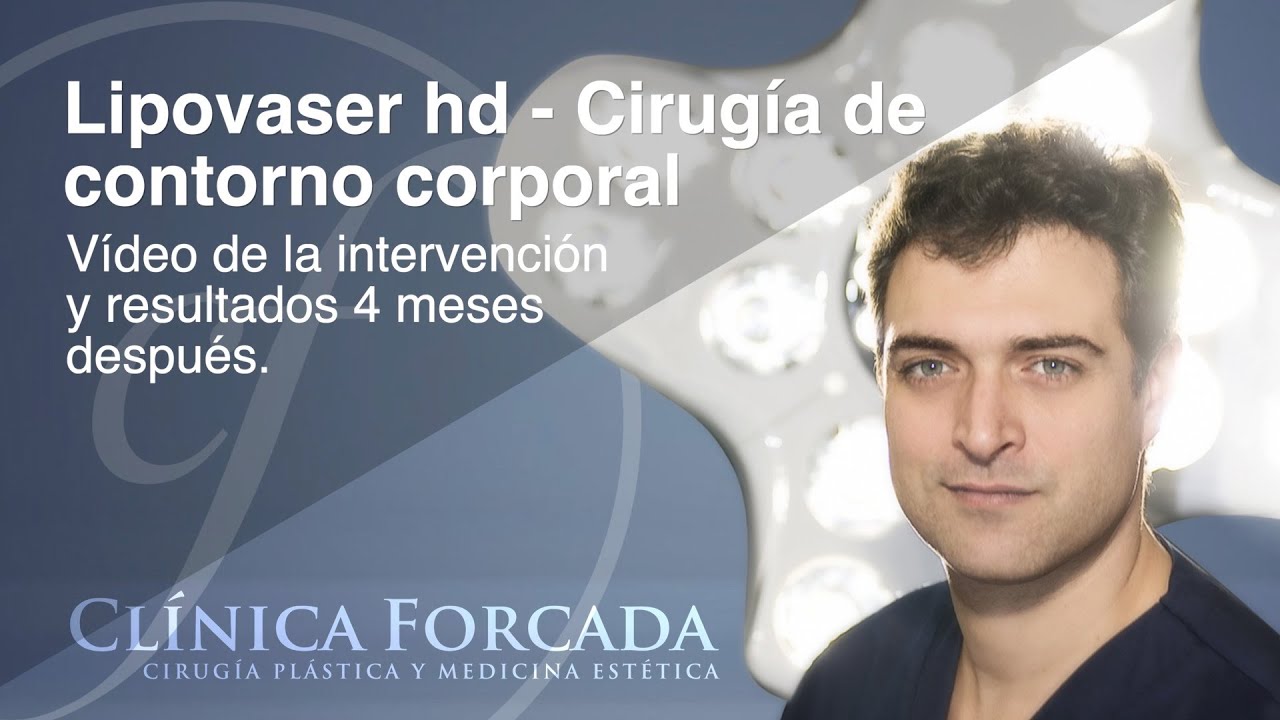 Eduardo Forcada Melero-37