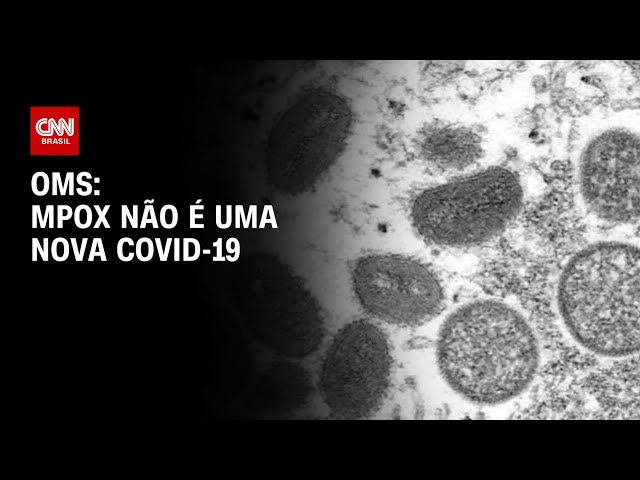 QUEM: Mpox não é um novo Covid-19 | Horário nobre da CNN