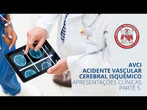 AVCI   ACIDENTE VASCULAR CEREBRAL ISQUÊMICO  - APRESENTAÇÕES CLÍNICAS   PARTE 5 - Dr Diogo