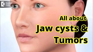 Jaw Cysts & Tumors  Diagnosis & Treatment - Dr. Girish Rao