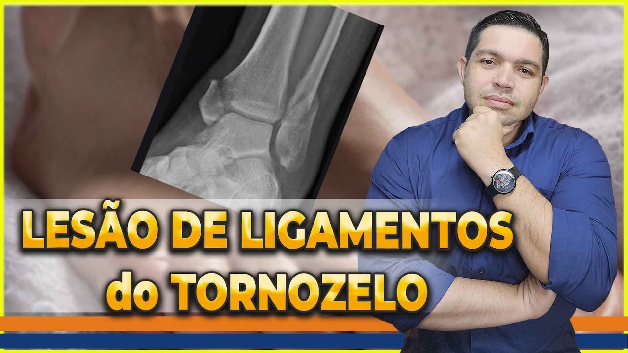 LIGAMENTOS DO TORNOZELO e as LESÕES POR INVERSÃO E EVERSÃO