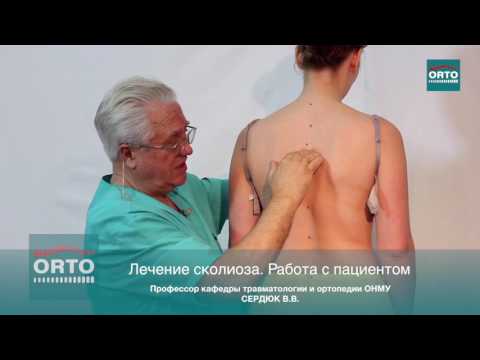 Сколиоз 2 степени не годен к службе У меня кифоз шейермана