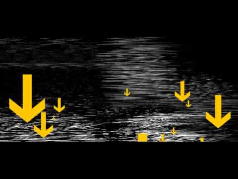 Big Narstie Ft Shystie, L-Man, Solo, J2k - Hold It Down