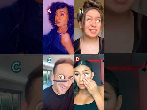 So,my eyes are correct! Who's your 😍😍😍? #funny #shorts #trend #fyp #white eyes #tiktok