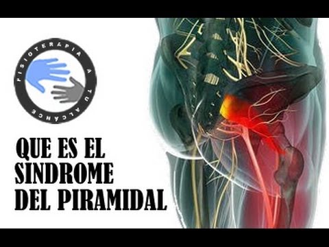 Pyramidal or piriformis syndrome, what it is and why it occurs