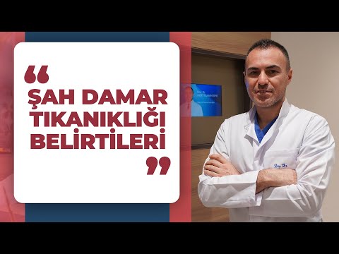 Şah Damar (Karotis Arter) Tıkanıklığı Belirtileri Nelerdir? | PROF. DR. MERT DUMANTEPE