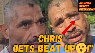 49, CHRIS (thugbait) UPDATE, I got put in the hospital getting beat up last night! still homeless