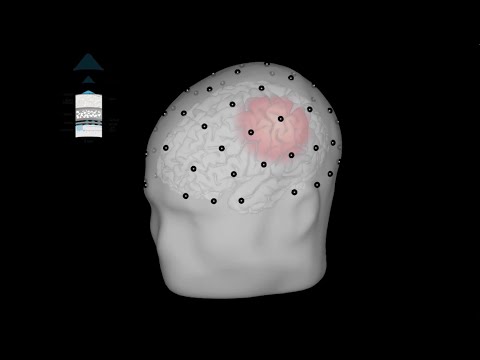 Intro to EEG and ECoG: Applications in Sleep, BCI, and Brain Mapping