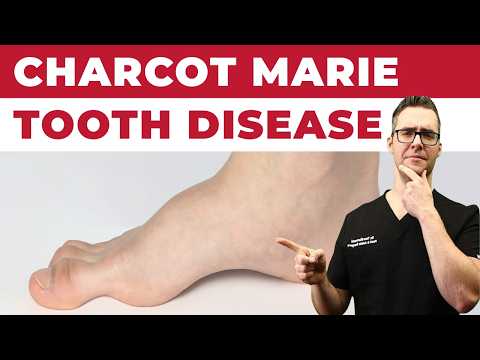 Charcot Marie Tooth Disease [Best Foot Treatment!]