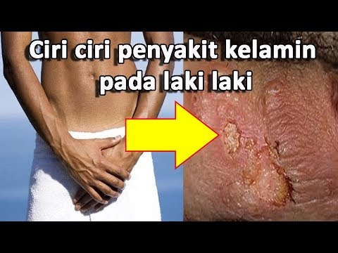 Obat tradisional untuk video potensi laki-laki Apakah pantang menyebabkan impotensi