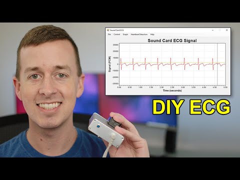 download lagu mp3 mp4 Ecg Diy, download lagu Ecg Diy gratis, unduh video klip Ecg Diy