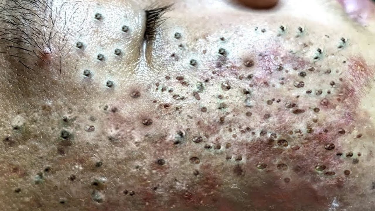 𝑺𝒐𝒐𝒕𝒉𝒊𝒏𝒈 𝑭𝒂𝒄𝒊𝒂𝒍 𝑻𝒓𝒆𝒂𝒕𝒎𝒆𝒏𝒕 𝑭𝒐𝒓 𝑺𝒕𝒓𝒆𝒔𝒔 𝑹𝒆𝒍𝒊𝒆𝒇 𝒂𝒕 𝑳𝒖𝒙𝒖𝒓𝒚 𝑺𝒑𝒂 𝑨𝒄𝒉𝒊𝒆𝒗𝒆 𝑰𝒏𝒏𝒆𝒓 𝑷𝒆𝒂𝒄𝒆 #887962