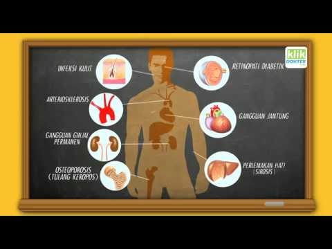 Frenulum plastik dari penis di Volgograd Posisi kontol kecil