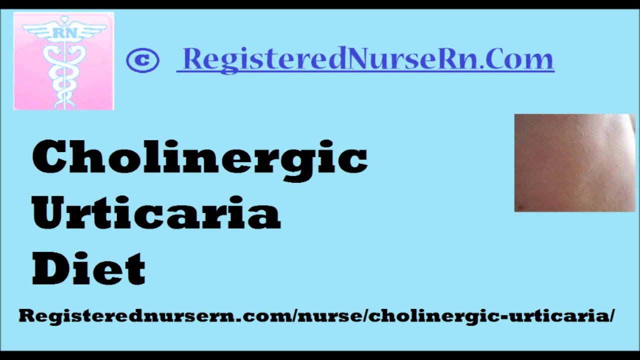 Cholinergic Urticaria Diet