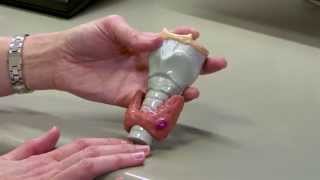 Subclinical Thyroid Dysfunction and Fracture Risk