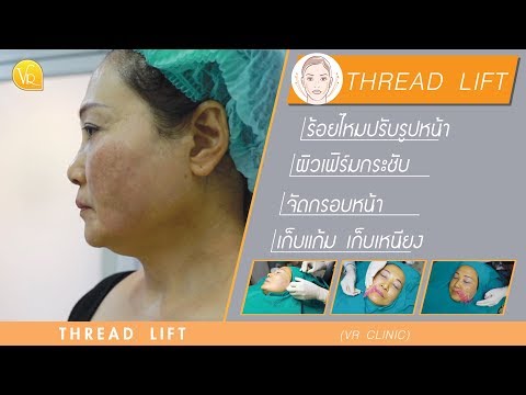 ร้อยไหม หน้าเรียว