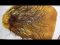 BRAZILIAN HAIRY UNDERARMS HARD WAXING FOR BEGINNERS BRAZILIAN EXPERIENCE Brazilian Viralvideo Wax