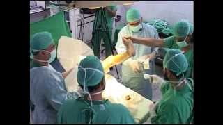 preview picture of video 'Live Total Knee Replacement - Civil Hospital Karachi (Dow Medical College) - Part. 1 of 4'