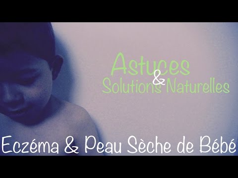 Il menù a dermatite atopic alladulto Eczemi di passaggio posteriore che questa fotografia