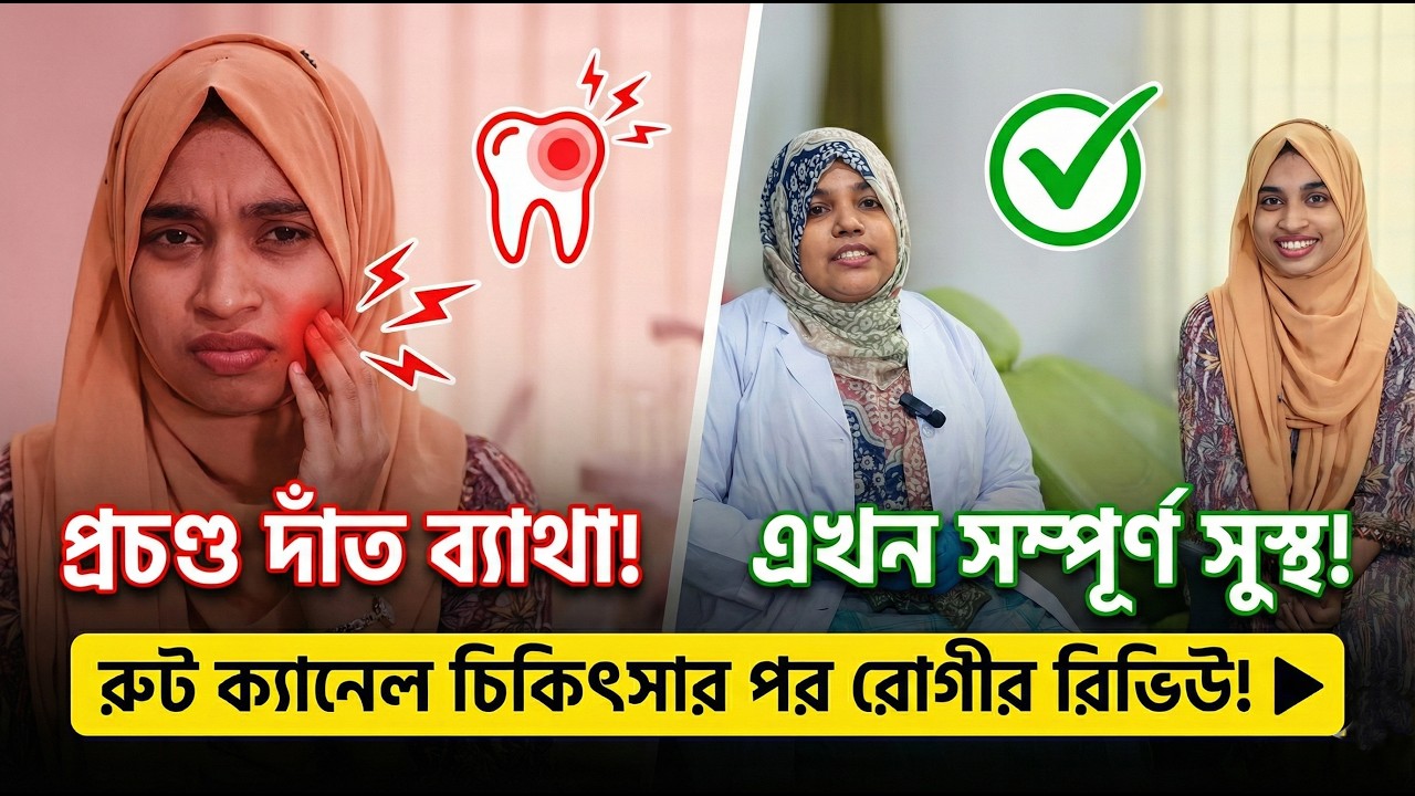 রুট ক্যানেল (Root Canal) মানেই কি তীব্র ব্যথা? আমাদের সম্মানিত রোগীর মুখে শুনুন আসল সত্যি! 💙🦷 - ভিডিও পর্যালোচনা