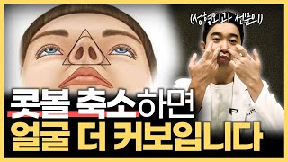 대부분 모르는 콧볼 축소 수술의 부작용 | 복코 교정 무작정 하지 마세요!